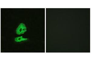 Immunofluorescence analysis of HeLa cells, using GLR antibody. (GLRa2 抗体  (Internal Region))