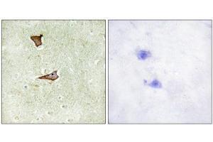 Immunohistochemistry (IHC) image for anti-Insulin-Like Growth Factor 2 Receptor (IGF2R) (pSer2409) antibody (ABIN1847436) (IGF2R 抗体  (pSer2409))
