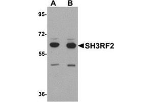 Western blot analysis of SH3RF2 in 3T3 cell lysate with SH3RF2 antibody at (A) 1 and (B) 2 μg/ml. (SH3RF2 抗体  (C-Term))
