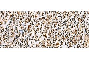 Immunohistochemistry of paraffin-embedded Human tonsil tissue using FOXI1 Polyclonal Antibody at dilution of 1:55(x200)