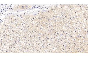 Immunohistochemistry (IHC) image for anti-5'-Nucleotidase, Ecto (CD73) (NT5E) (AA 29-500) antibody (ABIN7433327)