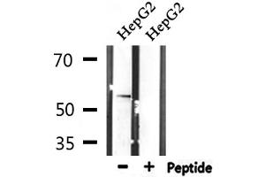 Western blot analysis of extracts from HepG2, using STK38L Antibody. (STK38L 抗体  (C-Term))