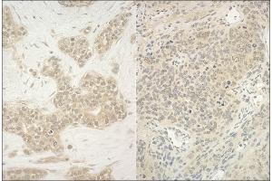 Immunohistochemistry (IHC) image for anti-YY1 Transcription Factor (YY1) (AA 50-100) antibody (ABIN7453812)