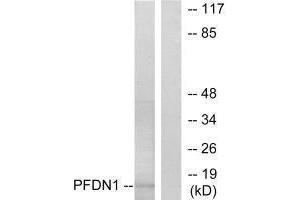 Western blot analysis of extracts from RAW264. (PFDN1 抗体)