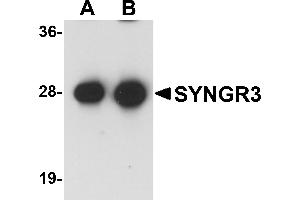 Western Blotting (WB) image for anti-Synaptogyrin 3 (SYNGR3) (C-Term) antibody (ABIN1030716) (Synaptogyrin 3 抗体  (C-Term))