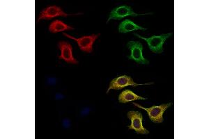 ABIN6256912 and ABIN6274865 staining Hela cells by IF/ICC. (Arylsulfatase A 抗体  (Internal Region))