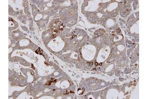 IHC-P Image Immunohistochemical analysis of paraffin-embedded NCI-N87 xenograft, using ESE1 , antibody at 1:100 dilution. (ELF3 抗体  (C-Term))