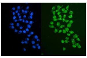 IF analysis of PARP2 using anti-PARP2 antibody (ABIN7599929). (PARP2 抗体  (AA 13-253))