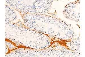 ABIN6267072 at 1/100 staining mouse testis tissue sections by IHC-P. (JAK1 抗体  (pTyr1022, pTyr1023))