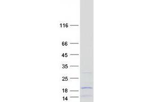MRPL52 Protein (Transcript Variant 1) (Myc-DYKDDDDK Tag)