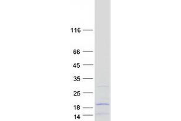 MRPL52 Protein (Transcript Variant 1) (Myc-DYKDDDDK Tag)