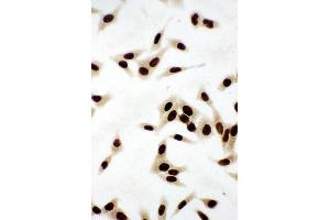 Anti-Ku80 antibody,  ICC ICC: HELA Cell