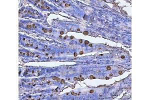 IHC analysis of TFF3 using anti-TFF3 antibody (ABIN5692886). (TFF3 抗体  (AA 23-81))