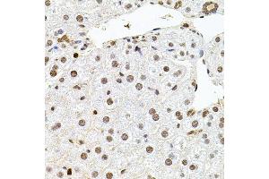 Immunohistochemistry of paraffin-embedded mouse liver using U2SURP antibody (ABIN6132839, ABIN6149759, ABIN6149760 and ABIN6220240) at dilution of 1:100 (40x lens). (SR140 抗体  (AA 705-1029))