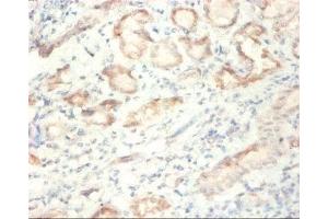 Immunohistochemistry of paraffin-embedded human kidney tissue using ABIN7170886 at dilution of 1:50 (SDHA 抗体  (AA 44-664))