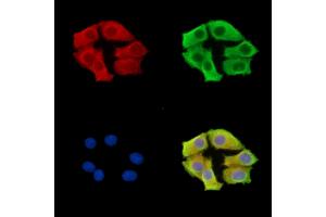 ABIN7096615 and ABIN7100679 staining HepG2 cells by IF/ICC. (ARMC9 抗体)