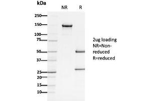 SDS-PAGE Analysis Purified APC Mouse Monoclonal Antibody (ALi 12-28). (APC 抗体  (AA 1-433))