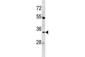 AQP3 antibody western blot analysis in MDA-MB453 lysate (AQP3 抗体  (AA 163-191))