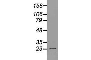 Western blot analysis of 35 µg of cell extracts from human (HeLa) cells using anti-NEUROG1 antibody. (Neurogenin 1 抗体)