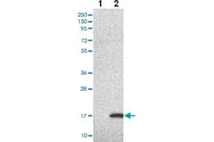 Western blot analysis of Lane 1: Negative control (vector only transfected HEK293T lysate) Lane 2: Over-expression Lysate (Co-expressed with a C-terminal myc-DDK tag (~3. (LSM5 抗体)