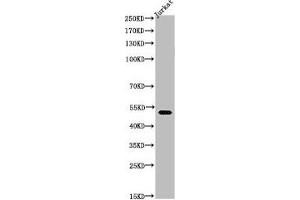 Western Blot analysis of Jurkat cells using Acetyl-Tubulin α (K40) Polyclonal Antibody (TUBA1A 抗体  (acLys402))