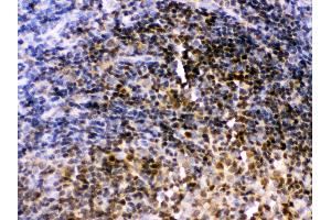 Anti- Pax2 Picoband antibody,IHC(P) IHC(P): Rat Lymphaden Tissue (PAX2A 抗体  (C-Term))