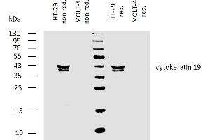 Western Blotting (WB) image for anti-Keratin 19 (KRT19) antibody (ABIN94288)