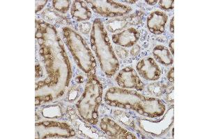 Immunohistochemistry of paraffin-embedded rat kidney using Adenylate kinase 4 Rabbit mAb (ABIN7265467) at dilution of 1:100 (40x lens). (AK4 抗体)