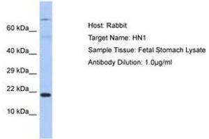 Image no. 1 for anti-Hematological and Neurological Expressed 1 (HN1) (C-Term) antibody (ABIN6750353) (HN1 抗体  (C-Term))