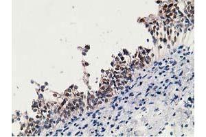 Image no. 2 for anti-Hydroxyprostaglandin Dehydrogenase 15-(NAD) (HPGD) antibody (ABIN1496361) (HPGD 抗体)