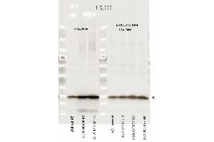 Western Blotting (WB) image for anti-Myosin, Light Chain 12A, Regulatory, Non-Sarcomeric (MYL12A) (pSer19), (pSer20) antibody (ABIN117974)