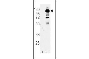 Western blot analysis of PI3KCG Antibody (Center) Pab (ABIN392817 and ABIN2842248) (arrow) using purified Pab.