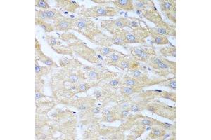 Immunohistochemistry of paraffin-embedded human liver using NUDT15 antibody. (NUDT15 抗体  (AA 1-164))