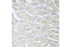 Immunohistochemistry (Paraffin-embedded Sections) (IHC (p)) image for anti-Nudix (Nucleoside Diphosphate Linked Moiety X)-Type Motif 15 (NUDT15) (AA 1-164) antibody (ABIN6144931)