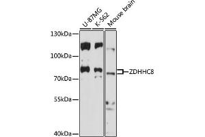 Western blot analysis of extracts of various cell lines, using ZDHHC8 antibody (ABIN7271556) at 1:1000 dilution. (ZDHHC8 抗体  (AA 240-380))