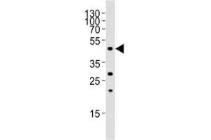 Western blot analysis of lysate from rat liver tissue, using FOXA2 antibody at 1:1000.