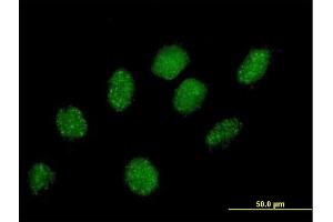 Immunofluorescence of purified MaxPab antibody to PRPF40A on HeLa cell. (PRPF40A 抗体  (AA 1-215))