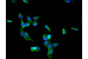 Immunofluorescence staining of SH-SY5Y cells with ABIN7172718 at 1:66, counter-stained with DAPI. (BACH2 抗体  (AA 136-235))