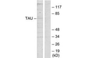 Western blot analysis of extracts from HeLa cells, using Tau (Ab-262) Antibody. (tau 抗体  (AA 551-600))