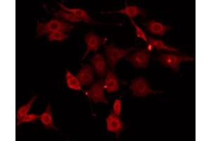 ABIN6274418 staining HepG2 by IF/ICC. (MAP4K3 抗体  (N-Term))