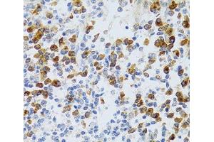 Immunohistochemistry of paraffin-embedded Human tonsil using CHAF1B Polyclonal Antibody at dilution of 1:100 (40x lens). (CHAF1B 抗体)