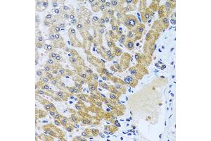 Immunohistochemistry of paraffin-embedded human liver using CPA6 antibody (ABIN6291611) at dilution of 1:100 (40x lens). (CPA6 抗体)