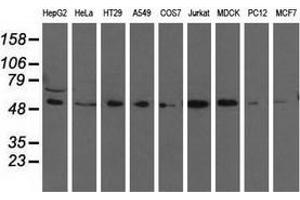 Western blot analysis of extracts (35 µg) from 9 different cell lines by using anti-TCP11L2 monoclonal antibody. (TCP11L2 抗体)