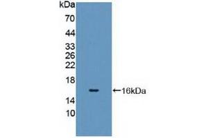 Detection of Recombinant CYP11A1, Human using Polyclonal Antibody to Cytochrome P450 11A1 (CYP11A1) (CYP11A1 抗体  (AA 392-521))
