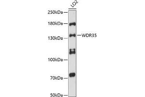 Western blot analysis of extracts of LO2 cells, using WDR35 antibody (ABIN6132986, ABIN6150192, ABIN6150193 and ABIN6216589) at 1:3000 dilution. (WDR35 抗体  (AA 871-1170))