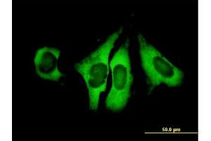 Immunofluorescence (IF) image for anti-Eukaryotic Translation Initiation Factor 4 Gamma, 1 (EIF4G1) (AA 1-645) antibody (ABIN515211)