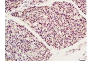 Formalin-fixed and paraffin embedded mouse embryo labeled with Rabbit Anti-FBXO11 Polyclonal Antibody, Unconjugated  at 1:200 followed by conjugation to the secondary antibody and DAB staining (FBXO11 抗体  (AA 65-160))