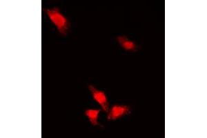 Immunofluorescent analysis of AKT (pS473) staining in MCF7 cells. (AKT1 抗体  (C-Term, pSer473))