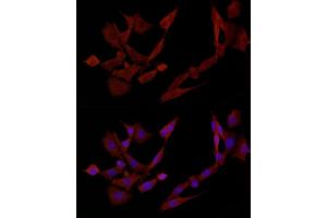Immunofluorescence analysis of PC-12 cells using DOK4 Rabbit pAb (ABIN3020721, ABIN3020722, ABIN3020723 and ABIN6213691) at dilution of 1:50 (40x lens).