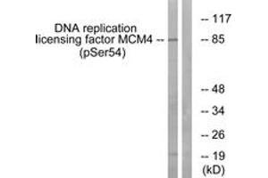 Western blot analysis of extracts from COS7 cells treated with nocodazole 1ug/ml 16h, using MCM4 (Phospho-Ser54) Antibody. (MCM4 抗体  (pSer54))